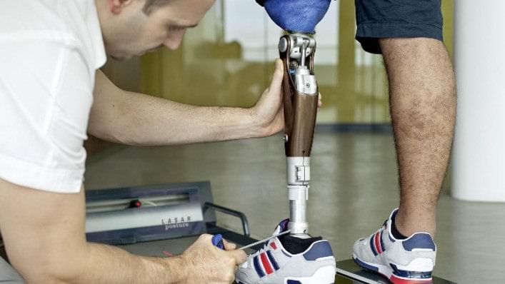 An amputee examines his interim leg prosthesis in the presence of his technician.