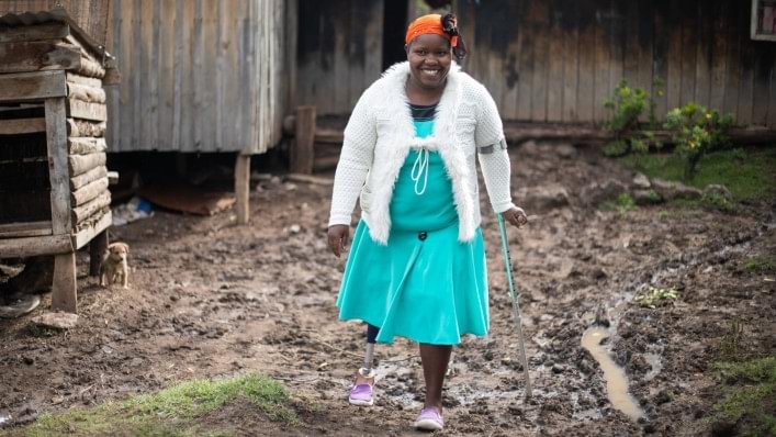 Agnes with her prosthesis